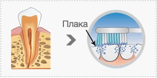 Ефект на премахване на зъбната плака (анти-плака)